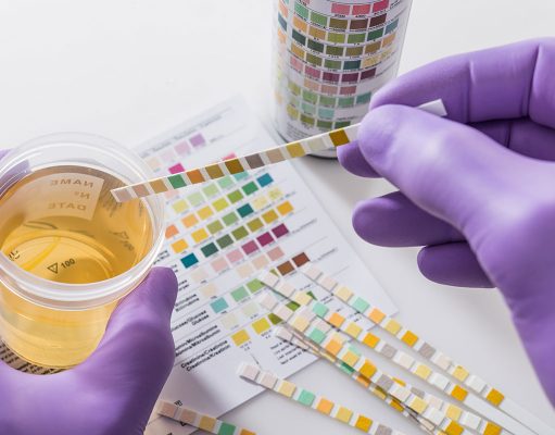 Does CBD Oil Show up In Drug Test?