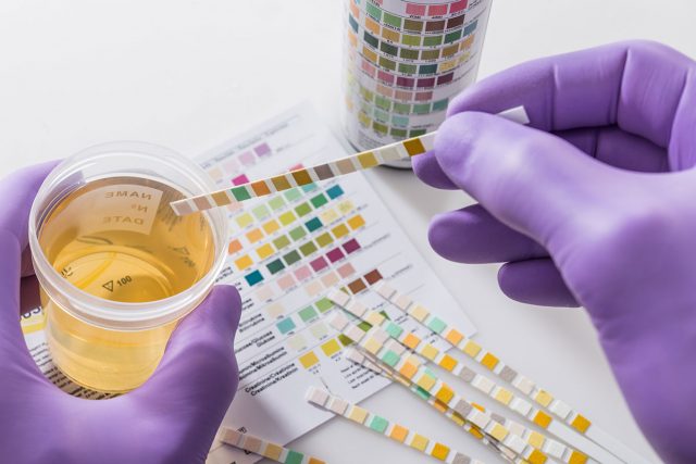 Does CBD Oil Show up In Drug Test?